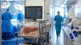 Біла Церква прийме 689 одиниць реабілітаційного обладнання з Німеччини