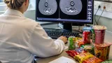 High intake of ultra‑processed foods fuels disease burden and rising costs, US report warns